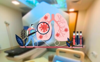 radioterapia in tratamentul cancerului pulmonar