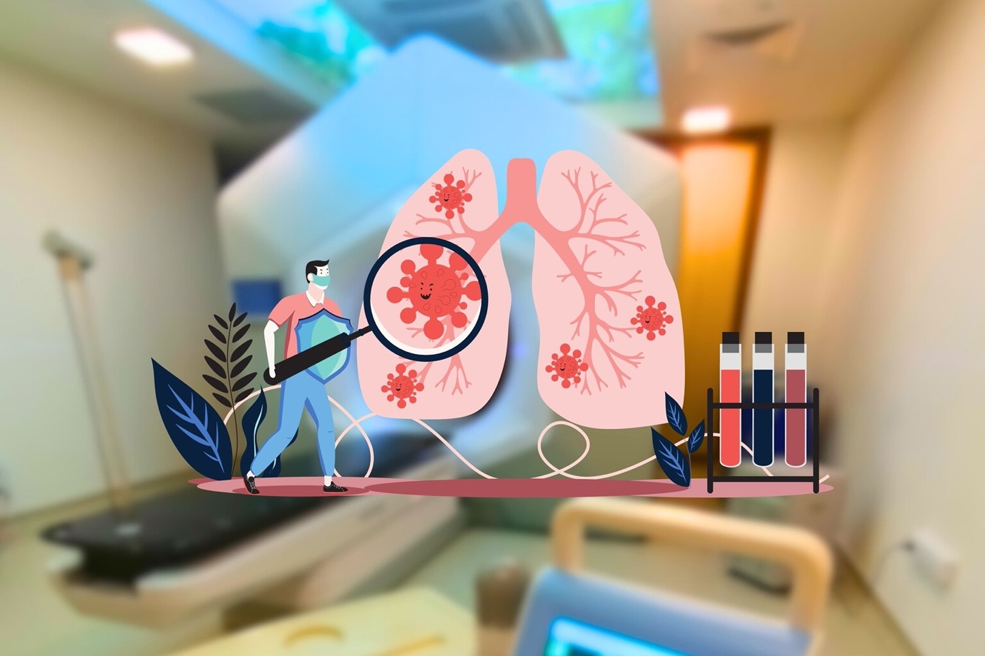 Radioterapia în Tratamentul Cancerului Pulmonar